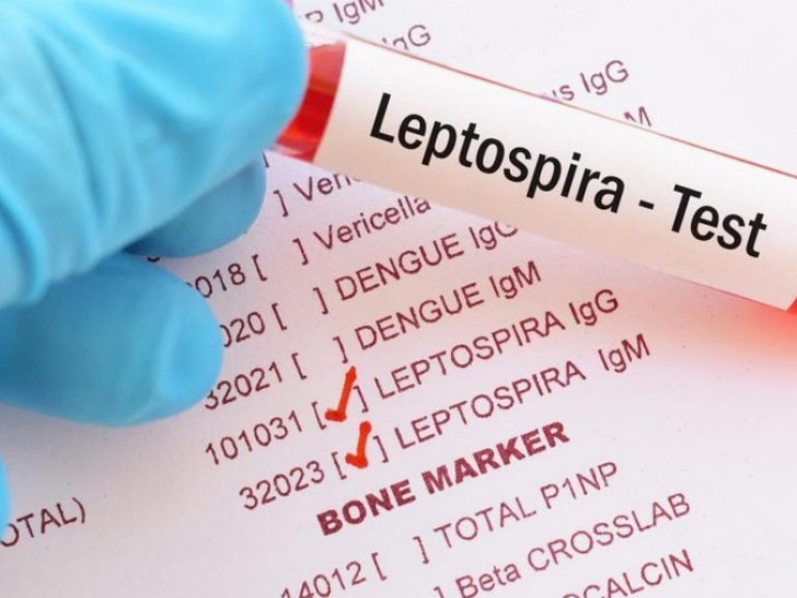 leptospiroza.jpg